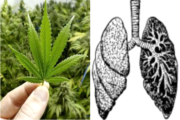 Lung diseases from weed | Adverse effects of marijuana